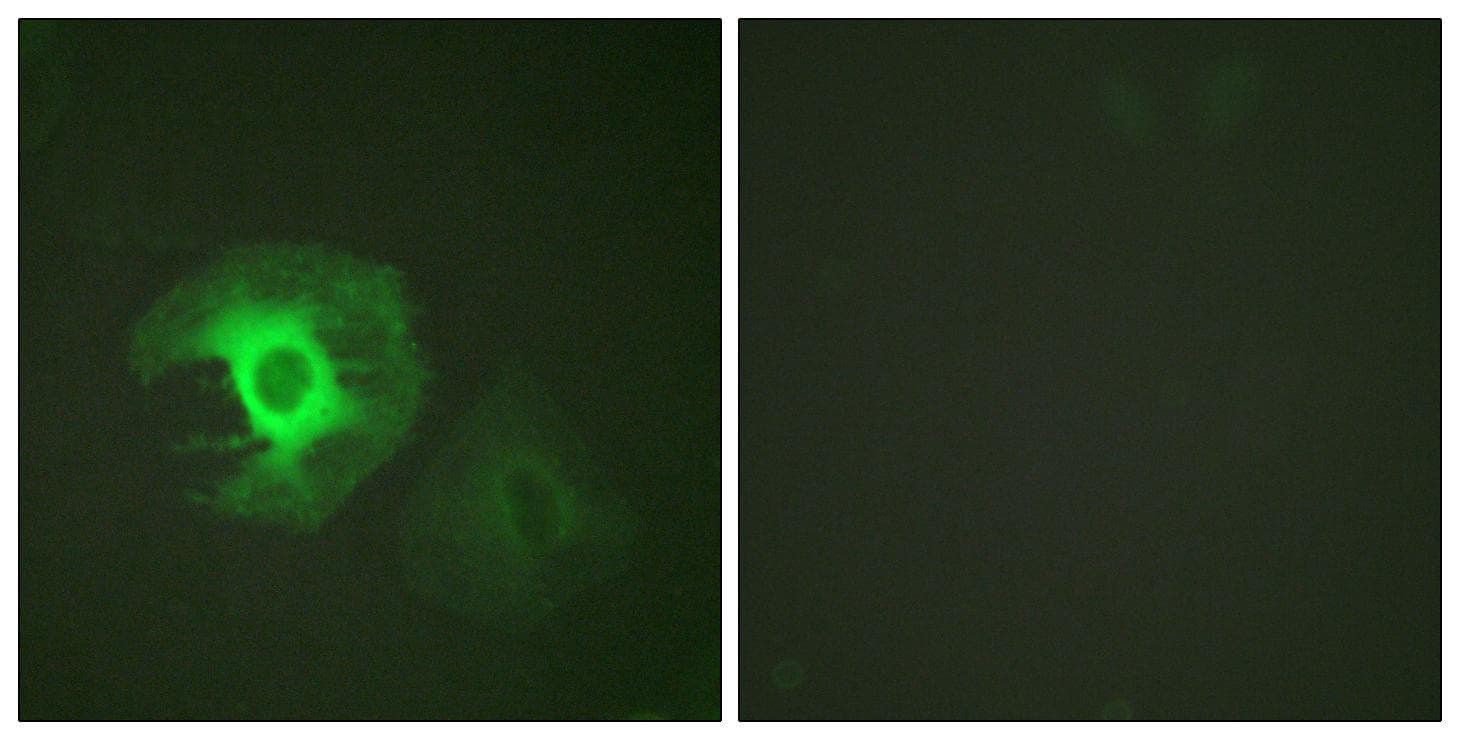 Polyclonal Rabbit anti-Human CALD1 / Caldesmon Antibody (p789, IHC, IF, WB)