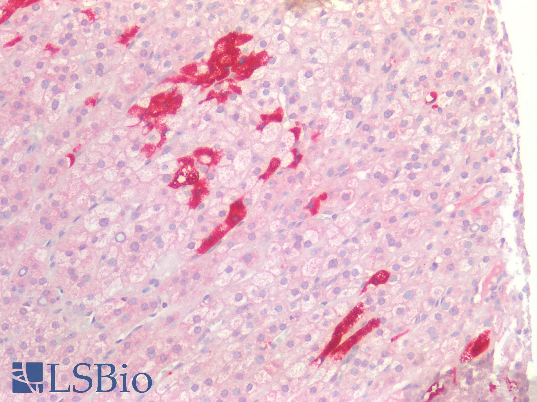 IHC-plus™ CDH3 / P-Cadherin Antibody