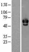 CHEK2 / CHK2 Protein (Over-Expression Lysate Myc-DDK (Flag))