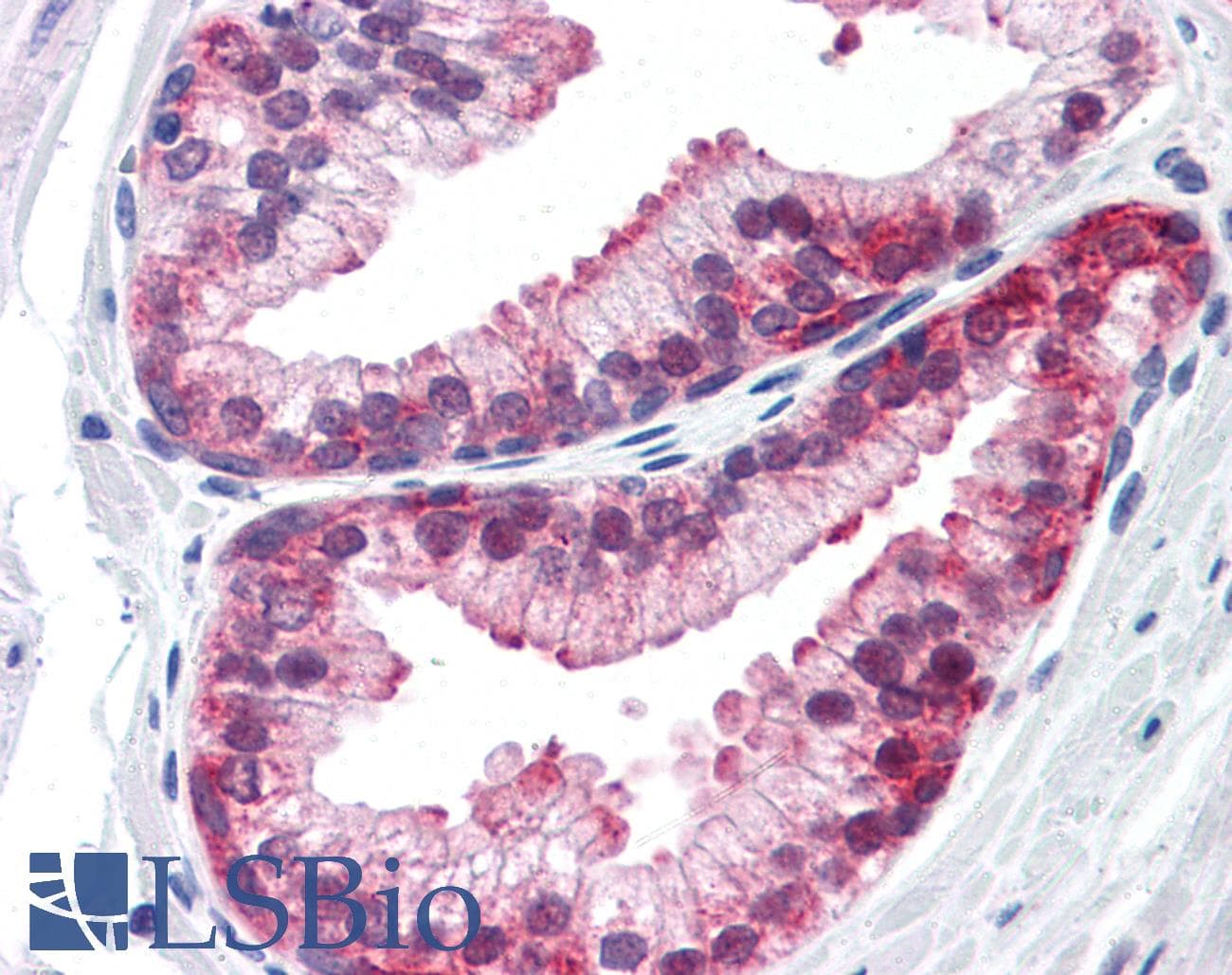 IHC-plus™ PAX2 Antibody (clone 3C7)
