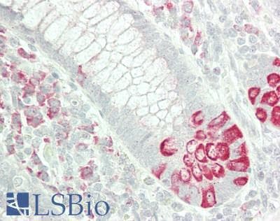 IHC-plus™ FST / Follistatin Antibody (90-170 aa, Internal)