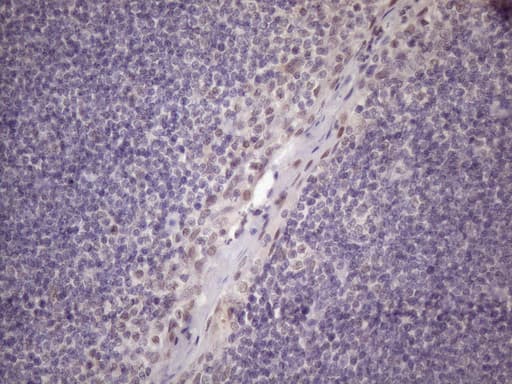 Monoclonal Mouse anti-Human SRSF9 / SFRS9 Antibody (clone OTI7F2, IHC, WB)