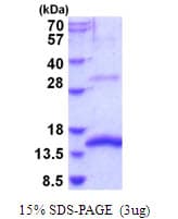 Mouse GDF15 Protein (Recombinant His)