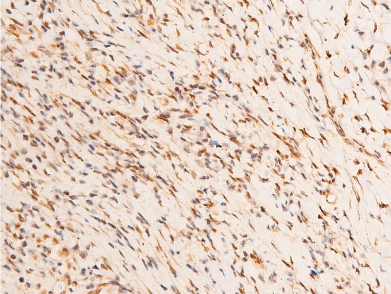 JUN / c-Jun Antibody (phospho-Thr93)