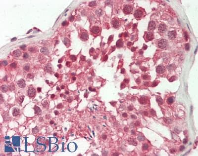 ADAM15 Antibody (HRP)