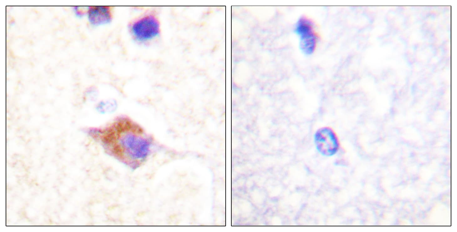 PLCG2 / PLC Gamma 2 Antibody (phospho-Tyr1217)