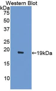 ACVR2 / ACVR2A Antibody (aa20-135)