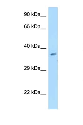 Polyclonal Rabbit anti-Human GET4 Antibody (aa32-81, WB)