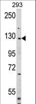 IHC-plus™ DAAM2 Antibody (aa68-97)