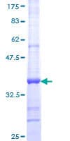 Human COUP-TFII / NR2F2 Protein (Recombinant GST, N-terminus)