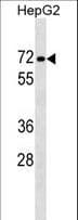 Polyclonal Rabbit anti-Human PPP1R16B Antibody (aa372-399, WB)
