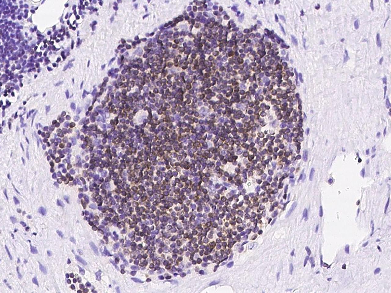 Monoclonal Mouse anti-Human BCL2 / Bcl-2 Antibody (clone 17, Preservative Free, IHC, WB)
