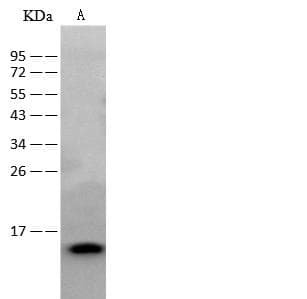 Calgizzarin / S100A11 Antibody (Preservative Free)