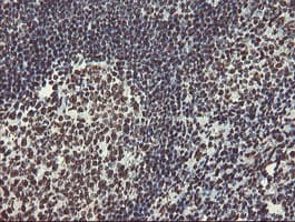 NONO / P54NRB Antibody (aa184-385, clone OTI5F1)