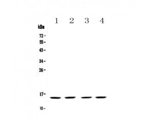 E-FABP / FABP5 Antibody