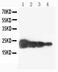 Polyclonal Rabbit anti-Human GH / Growth Hormone Antibody (aa27-217, IHC, WB)