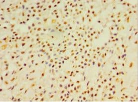 IHC-plus™ Polyclonal Rabbit anti-Human DEFB4A / BD-2 Antibody (aa1-64, IHC)