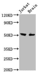 ONECUT1 / HNF6 Antibody