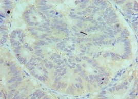 Complement C7 Antibody (aa22-270)