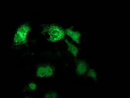 Monoclonal Mouse anti-Human ANKRD53 Antibody (clone OTI2F3, IF, WB)
