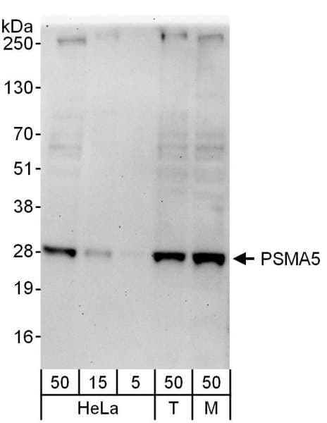PSMA5 Antibody (aa100-150)