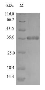 Mycobacterium smegmatis dps Protein (Recombinant 6His-SUMO, N-terminus)