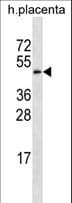 Polyclonal Rabbit anti-Human GAL3ST4 Antibody (aa201-230, WB)