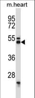 SYT7 / Synaptotagmin 7 Antibody (aa72-101)