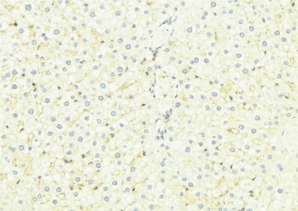 SARA2 / SAR1B Antibody