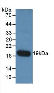 ANGPT1 / Angiopoietin-1 Antibody
