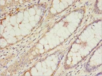 Polyclonal Rabbit anti-Human TRNAU1AP / TRSPAP1 Antibody (IHC, WB)