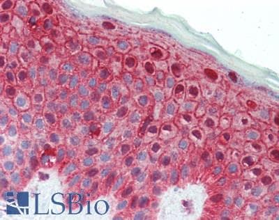 IHC-plus™ Polyclonal Rabbit anti-Human DSG1 / Desmoglein 1 Antibody (IHC, WB)