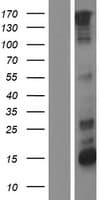 Human ERBB2 / HER2 Protein (Over-Expression Lysate Myc-DDK (Flag))