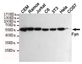 Monoclonal Mouse anti-Human SYN / FYN Antibody (WB)