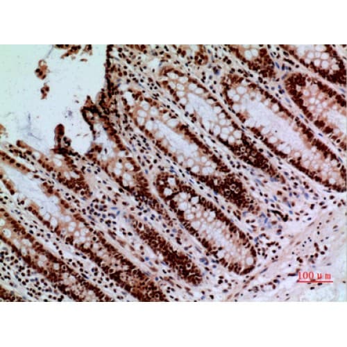 Polyclonal Rabbit anti-Human CACYBP Antibody (161-210 aa, C-terminal, IHC, WB)