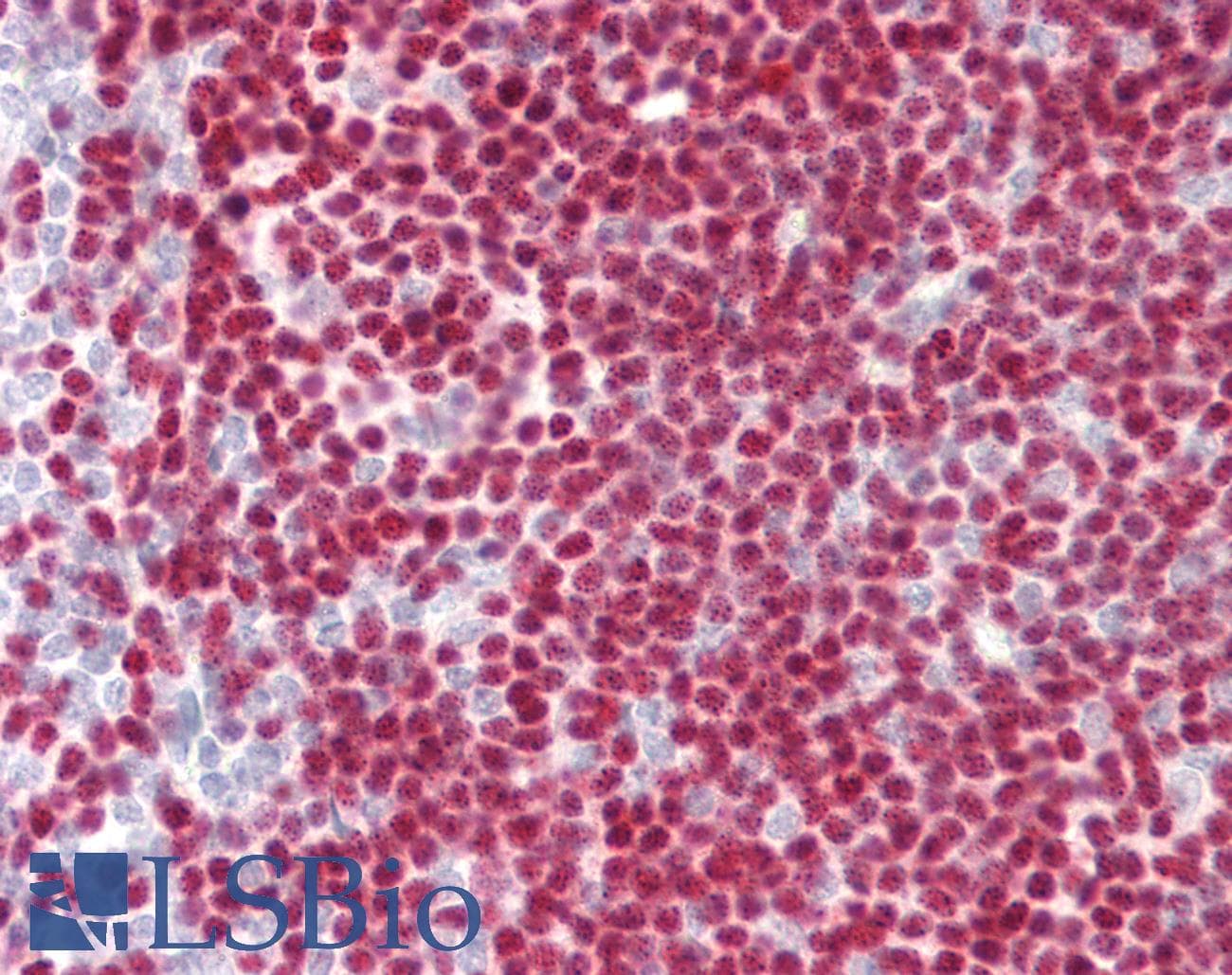 PathPlus™ PAX5 Antibody (clone 1H9)