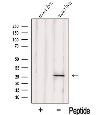 Polyclonal Rabbit anti-Human IDI1 / IPP1 Antibody (WB)