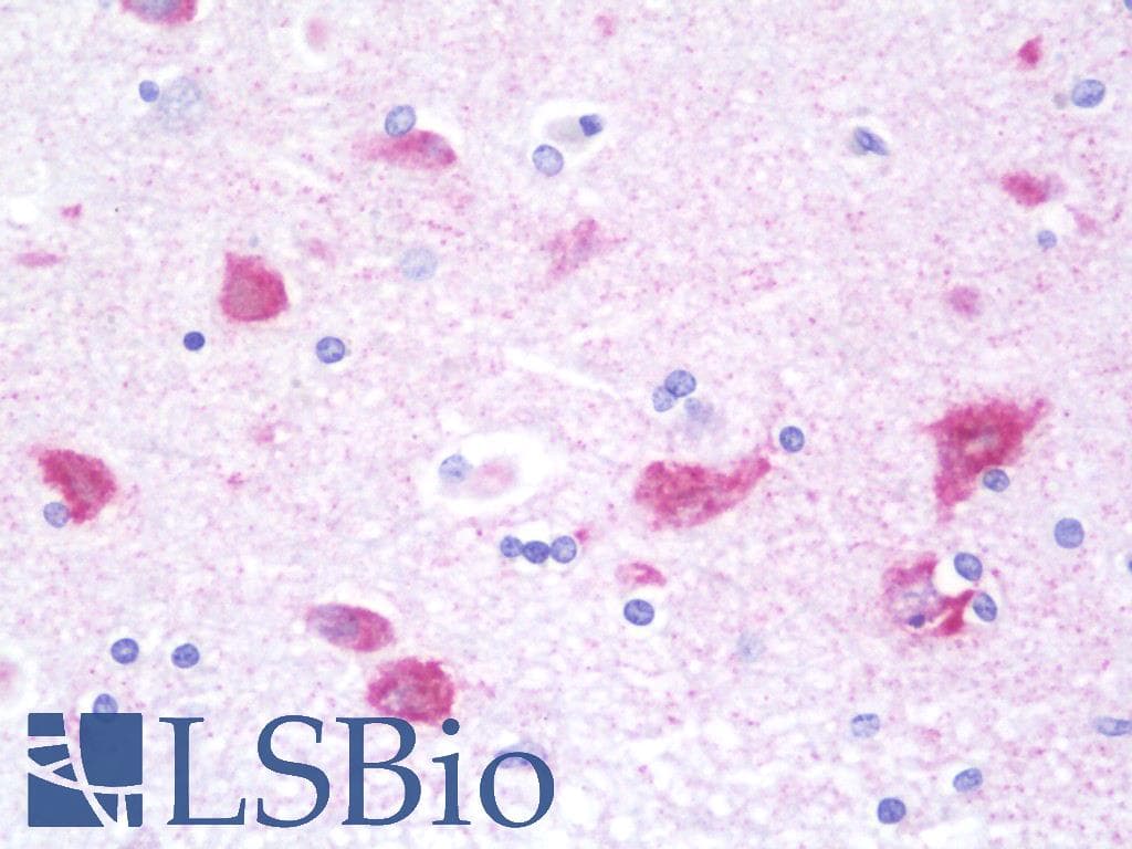 IHC-plus™ Polyclonal Rabbit anti-Human G3BP2 Antibody (aa433-482, IHC, WB)