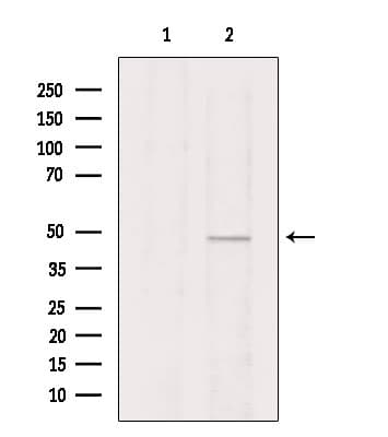 VPAC2 / VIPR2 Antibody