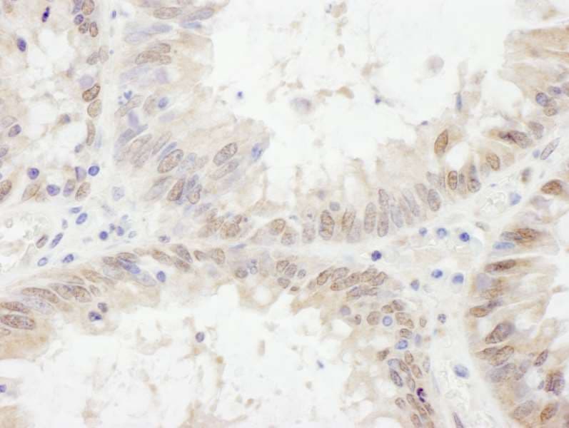 ETV6 / TEL Antibody (aa175-225)