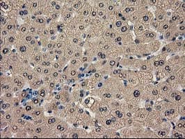 CAT / Catalase Antibody (clone OTI1B8)