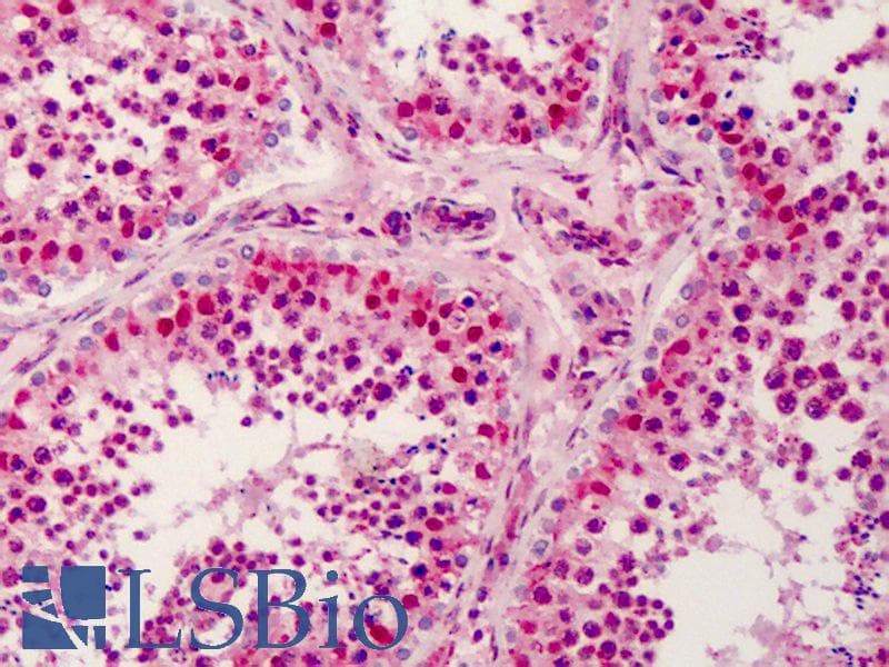 IHC-plus™ MAP3K5 / ASK1 Antibody
