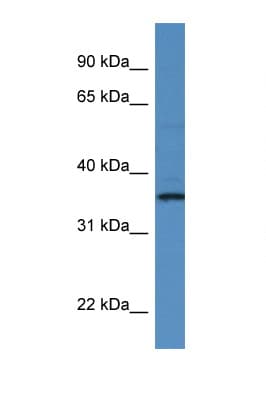 Polyclonal Rabbit anti-Human RIOK1 Antibody (aa233-282, WB)