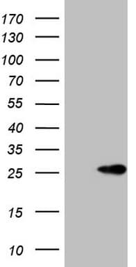 IHC-plus™ Monoclonal Mouse anti-Human ABCC5 / MRP5 Antibody (clone 6C6, IHC, WB)