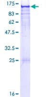 Human ARHGAP17 / NADRIN Protein (Recombinant GST)
