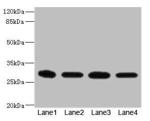 EIF3K Antibody