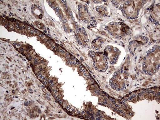 KRT7 / CK7 / Cytokeratin 7 Antibody (clone OTI2A2)