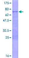 Human IQCD Protein (Recombinant GST)