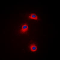 Polyclonal Rabbit anti-Human CAMK1 / CAMKI Antibody (phospho-Thr177, IHC, IF, WB)