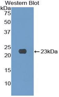 KLRC2 / NKG2C / CD159c Antibody (aa19-190)